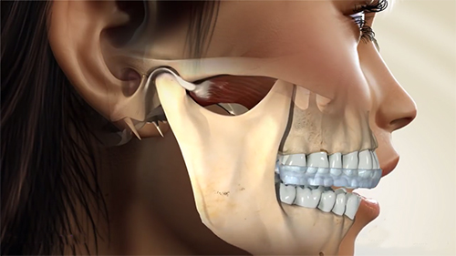 sariyer ortodonti ortodonti uzmani cene eklemi tedavisi ortodonti istanbul sariyer ortodonti